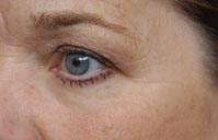 nuts_eye1
