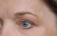 nuts_eye2