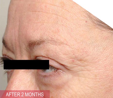 patient_after