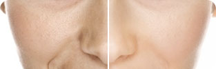 combination-img-7