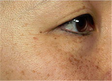 eye5