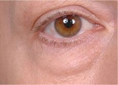 eye5
