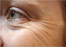 eye5