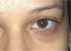 eye5